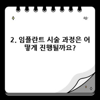 임플란트 시술 완벽 가이드: 성공적인 임플란트를 위한 A to Z